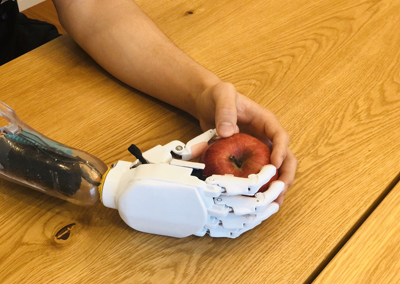 low cost prosthetic hand  prosthesis bionic hand 電動義手 筋電義手